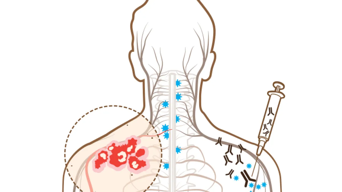 Canetas emagrecedoras aumentam risco de herpes-zóster