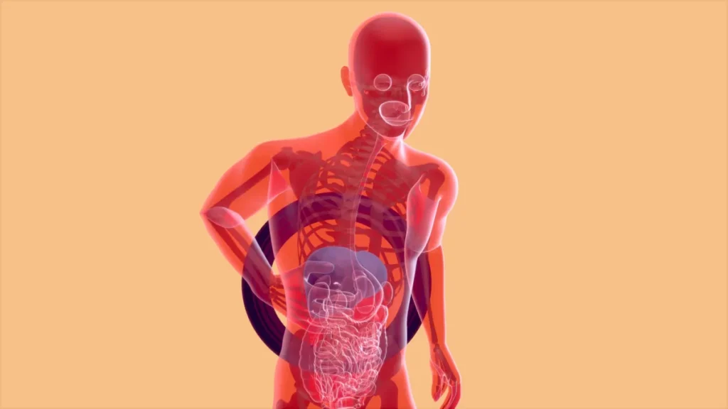Aneurisma de aorta: bomba-relógio silenciosa Aneurisma de aorta: bomba-relógio silenciosa
