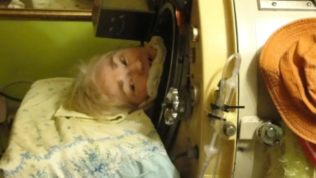 Martha Lillard: última a usar pulmão de aço nos EUA morre