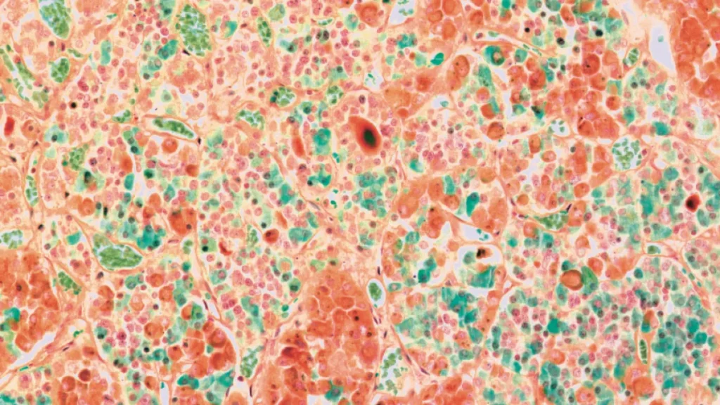 Hipófise: a glândula que comanda os hormônios Hipófise: a glândula que comanda os hormônios